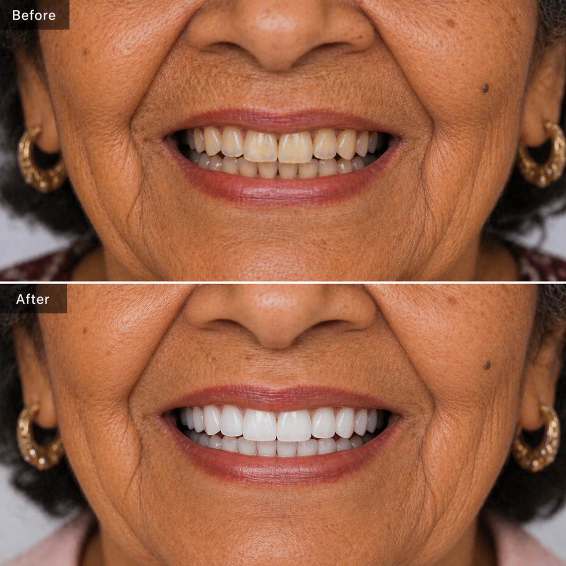 Before and after cosmetic dentistry for Upland patients
